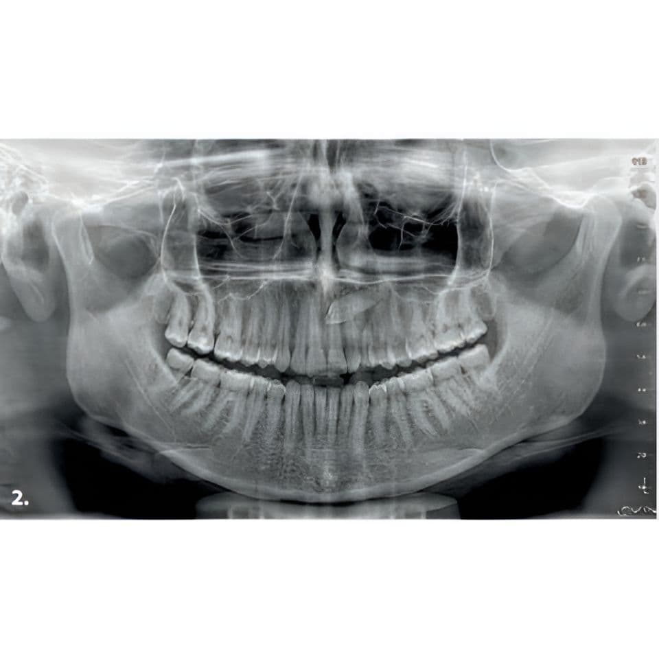 MyRay Hyperion X9 PRO Pan/Ceph/CBCT Dental X-Ray with 13x16 FOV thumbnail 5
