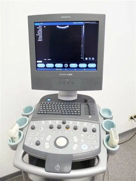 Siemens X300 Ultrasound System image 1