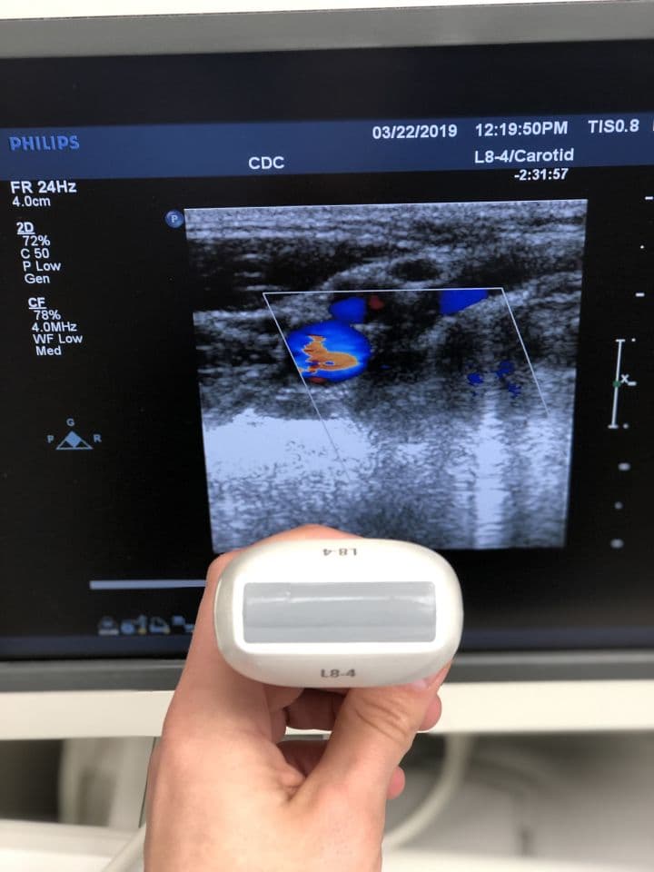 Philips L8-4 Linear Ultrasound Transducer Probe thumbnail 2