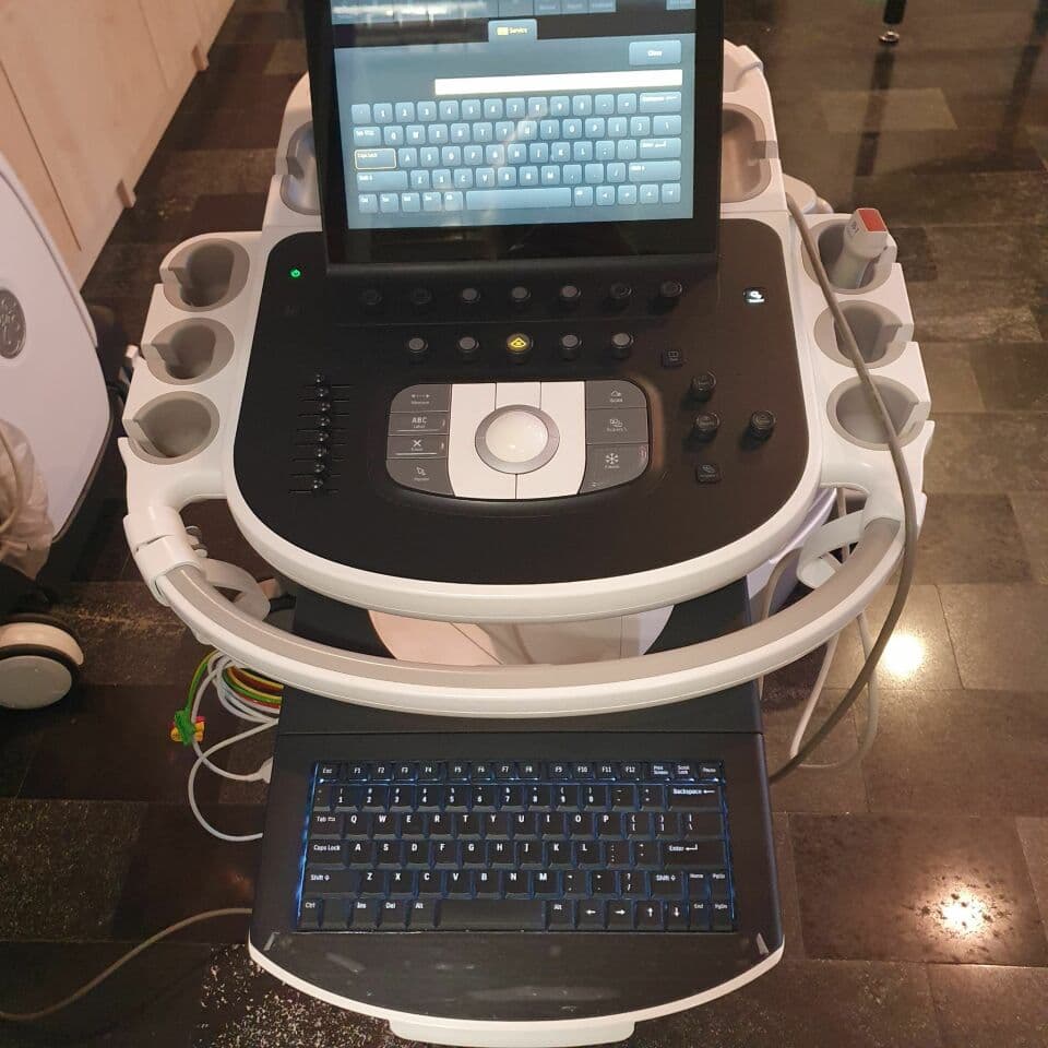 Refurbished Philips Epiq 5G PureWave Ultrasound System thumbnail 4