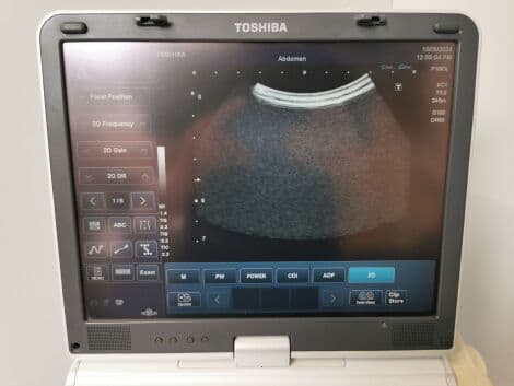 Toshiba Viamo Portable Ultrasound System thumbnail 9