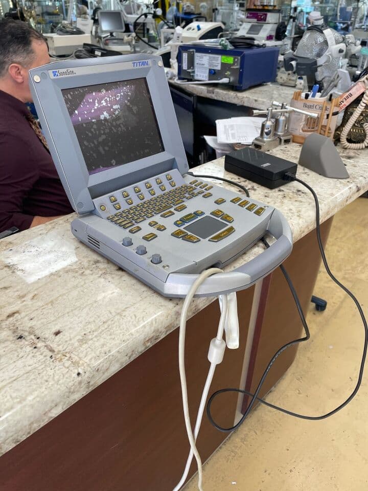 SonoSite Titan Vascular Small Parts Ultrasound System