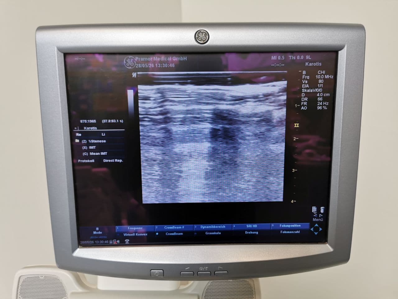 GE Healthcare 9L Linear Ultrasound Probe thumbnail 7