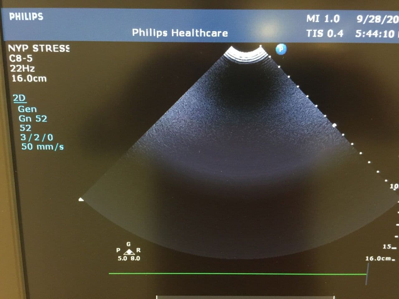 Philips C8-5 Convex Ultrasound Transducer Probe thumbnail 4