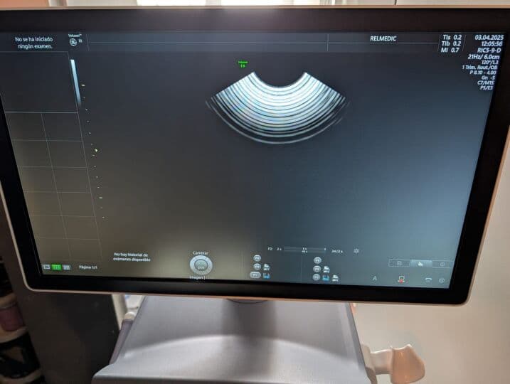 GE Voluson E8 OB/GYN Ultrasound System thumbnail 10