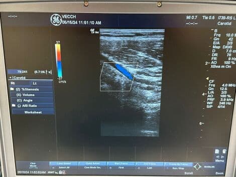 GE i739-RS Intraoperative Linear Ultrasound Transducer thumbnail 5