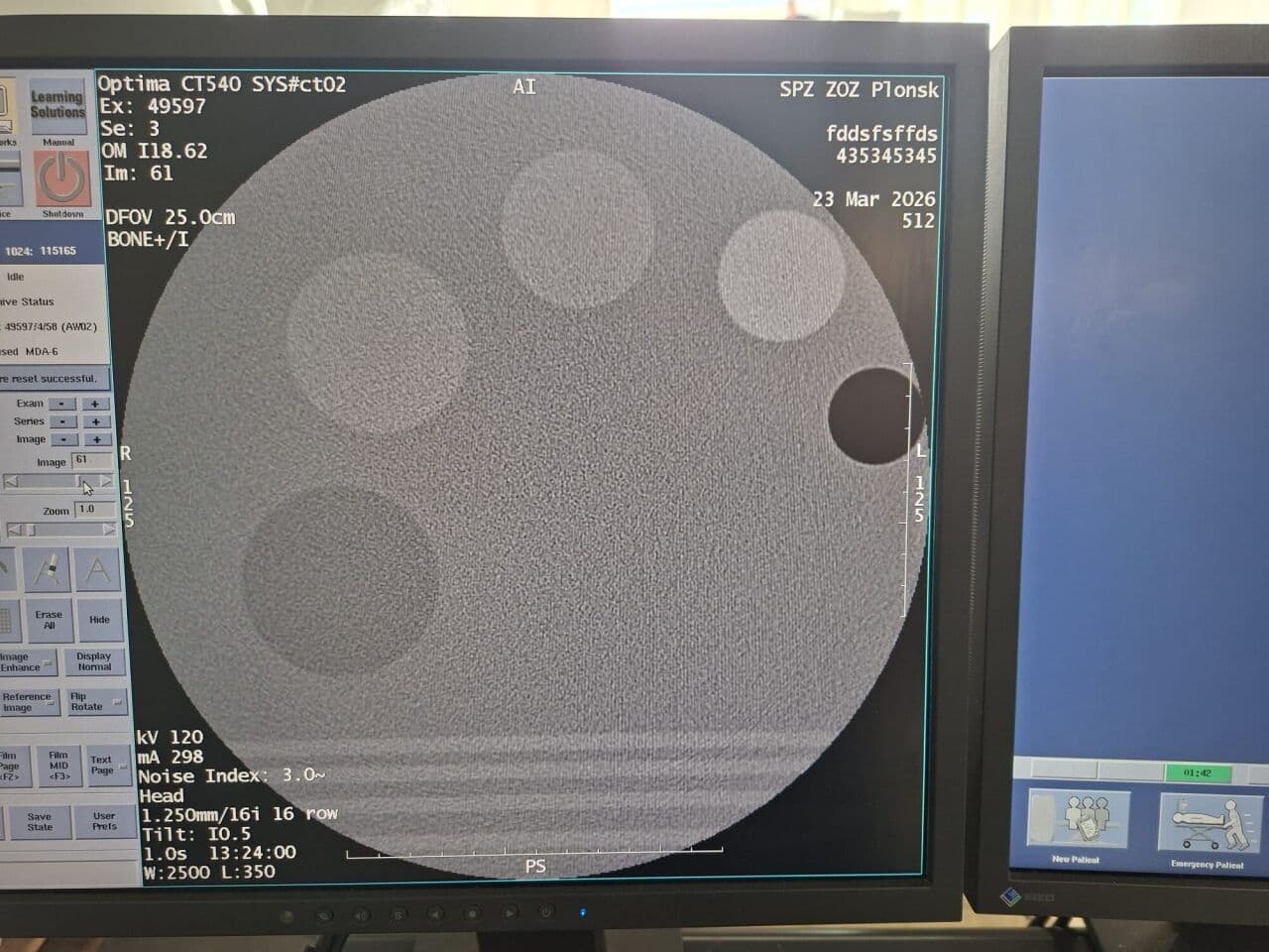 GE Optima CT540 16-Slice CT Scanner thumbnail 2