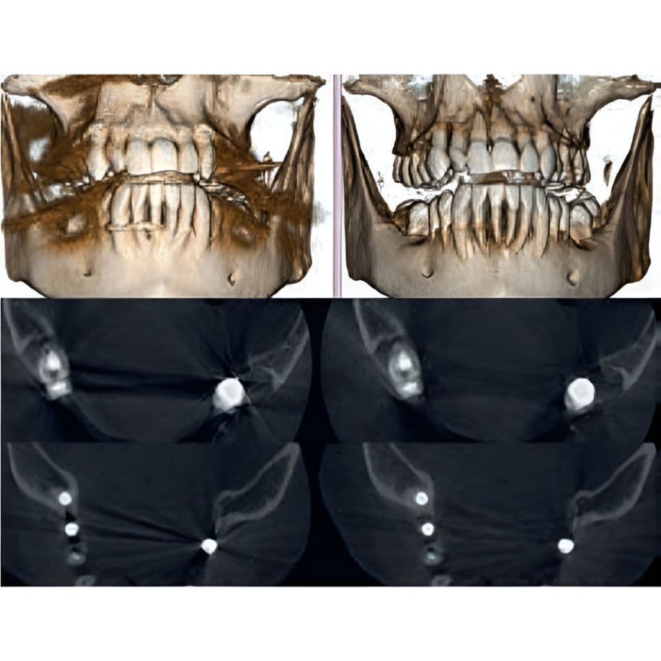 MyRay Hyperion X9 PRO Pan/Ceph/CBCT Dental X-Ray with 13x16 FOV thumbnail 2