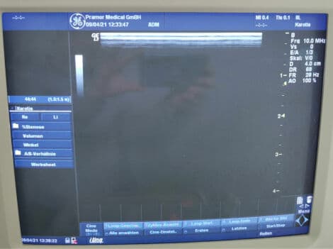 GE 8L (2376128) Linear Ultrasound Transducer thumbnail 2