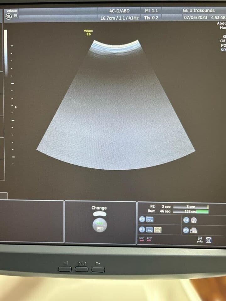 GE 4C-D Convex Ultrasound Transducer thumbnail 4