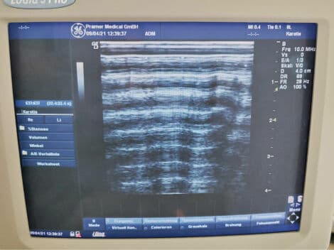 GE 8L (2376128) Linear Ultrasound Transducer thumbnail 3