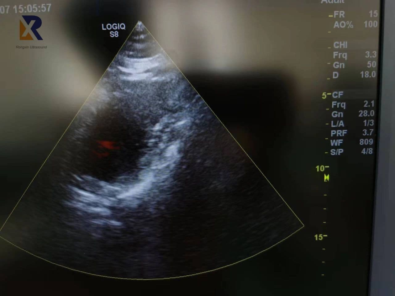 GE M5S-D Phased Array Ultrasound Transducer thumbnail 4
