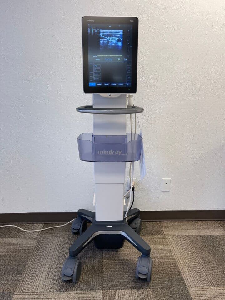 Mindray TE5 Musculoskeletal Ultrasound System image 1