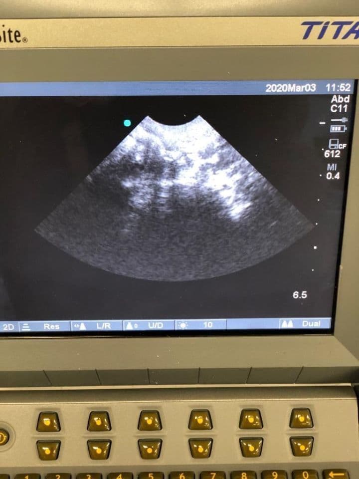 Sonosite C11 Ultrasound Transducer Probe thumbnail 3