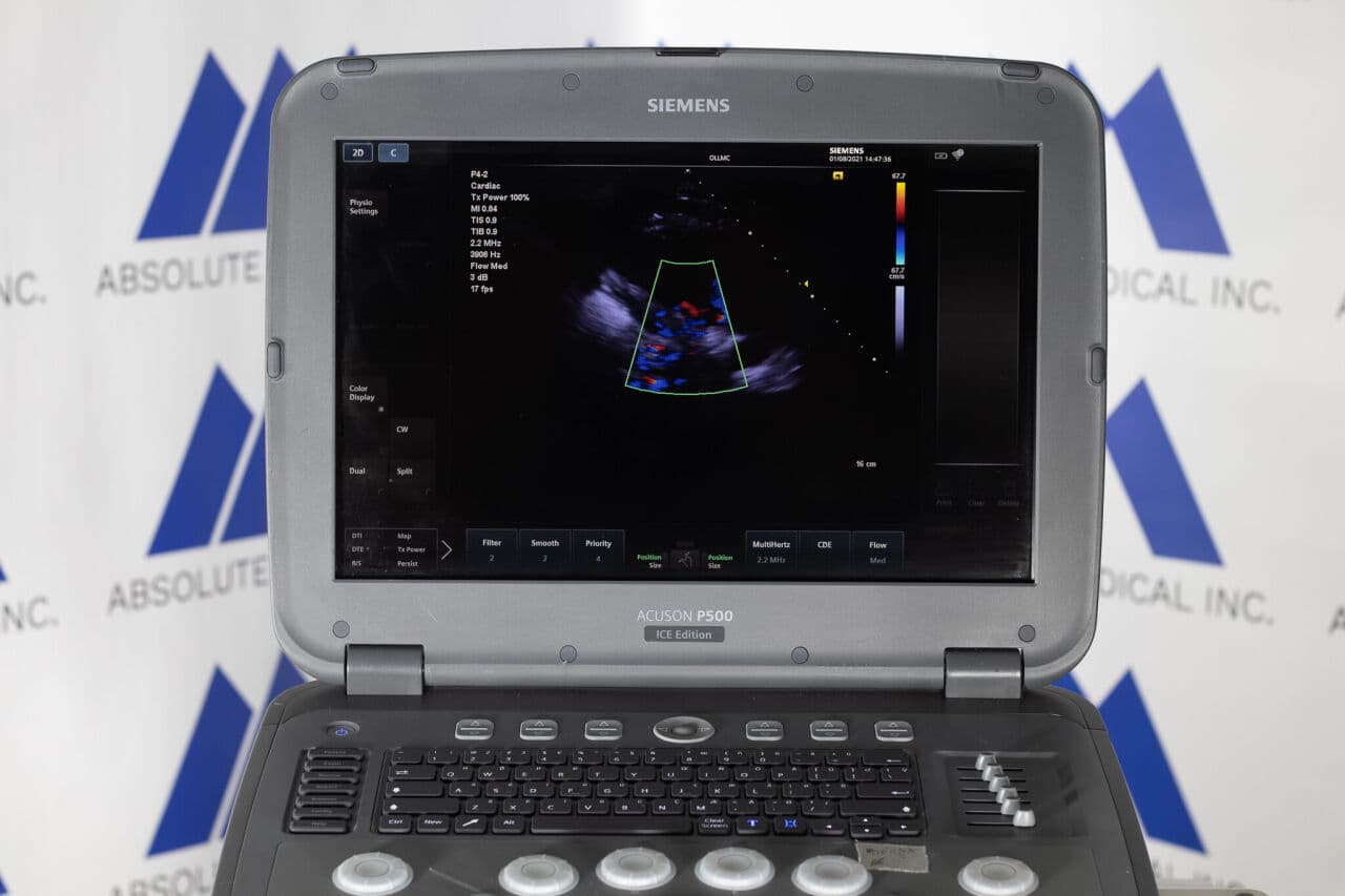 Siemens Acuson P500 Frosk Portable Ultrasound System thumbnail 8