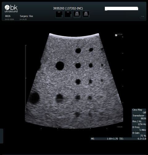 Robotic Drop-In Ultrasound Transducer — BK Medical 8826 thumbnail 6