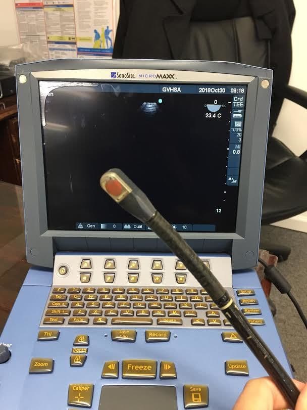 Sonosite TEE 8-3 MHz Ultrasound Transducer for Transesophageal Echocardiography image 1