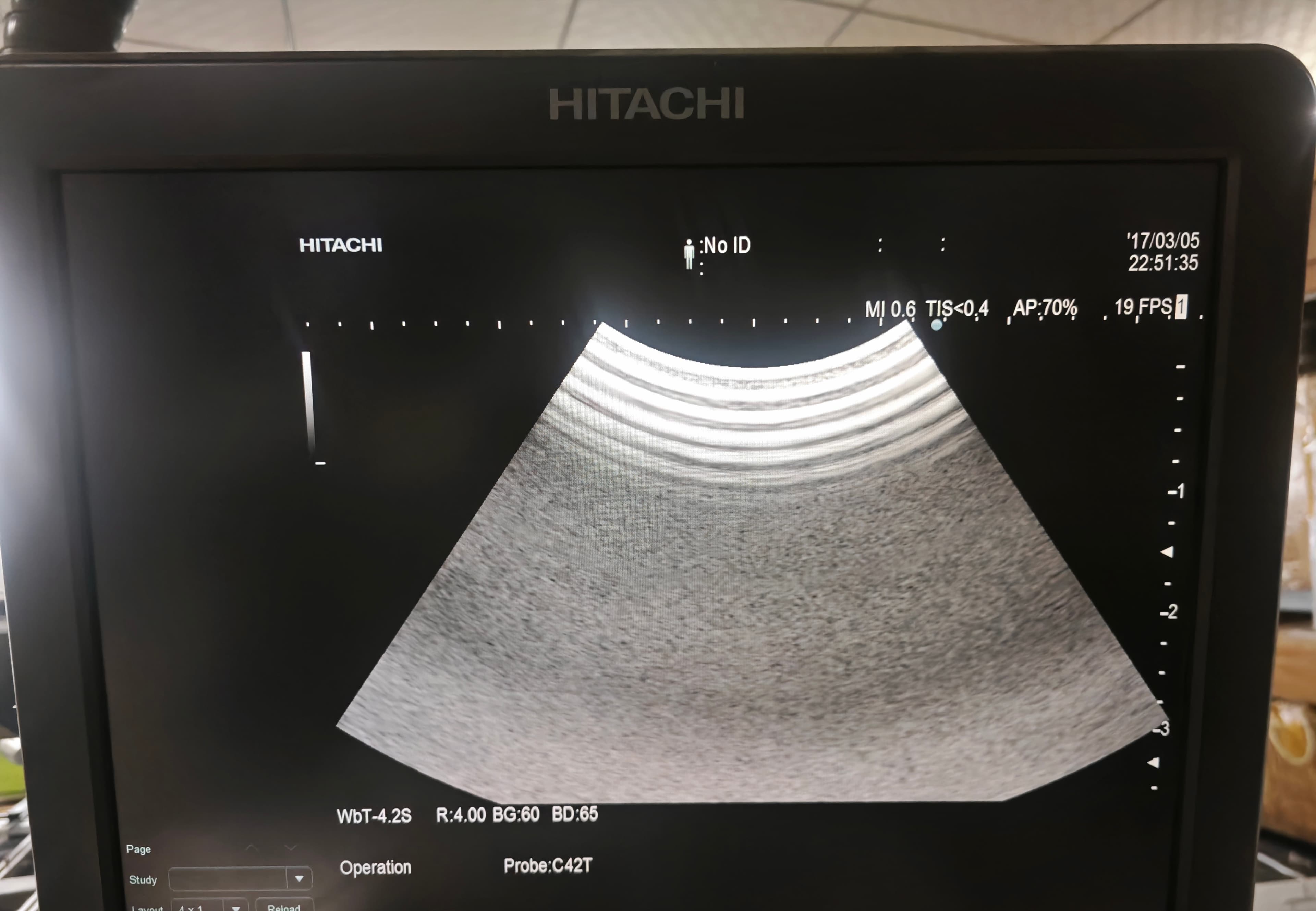 Used Hitachi C42T Intraoperative Curved Array Ultrasound Probe Tested Working thumbnail 6