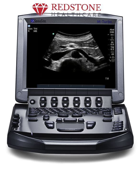 SonoSite M-Turbo Shared Service Ultrasound System thumbnail 3