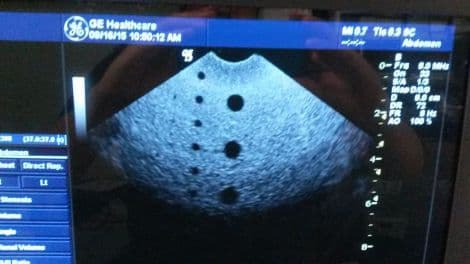 GE 8C Micro-Convex Ultrasound Transducer for Pediatric and Neonatal Applications thumbnail 4