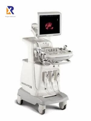 Samsung Medison SonoAce X8 4D OB/GYN & Vascular Ultrasound System