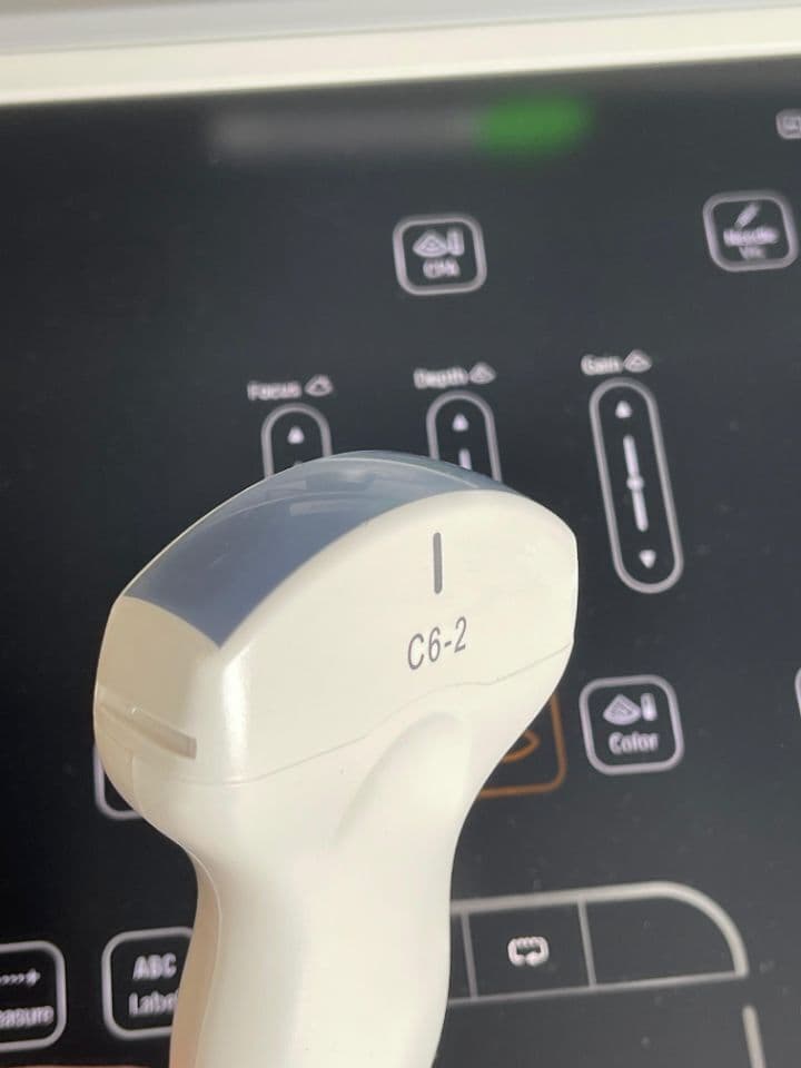 Philips Sparq Ultrasound System thumbnail 4