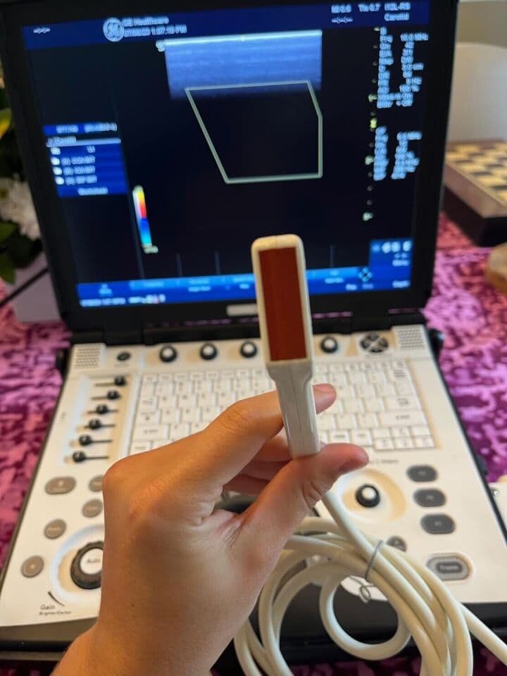 GE i12L-RS Linear Array Ultrasound Transducer thumbnail 2