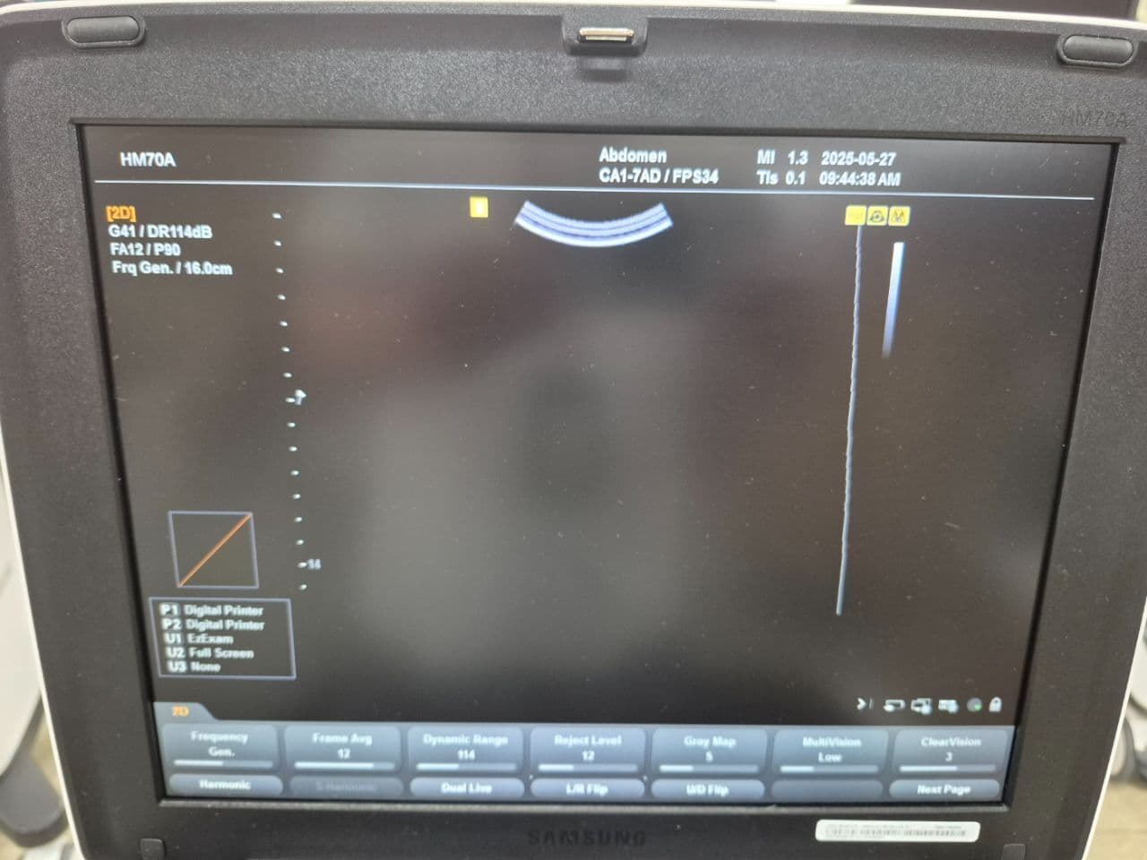 Samsung CA1-7AD Convex Ultrasound Transducer thumbnail 5