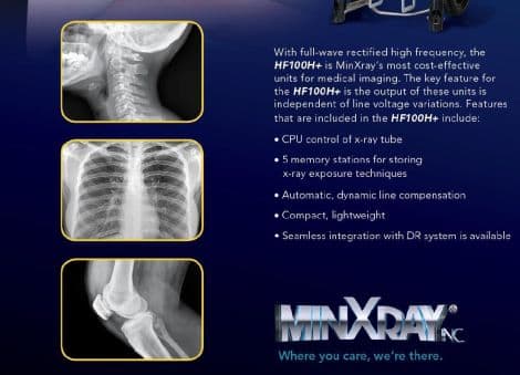 Compact and Lightweight MinXray HF100H XGS MkII Portable X-Ray System thumbnail 2