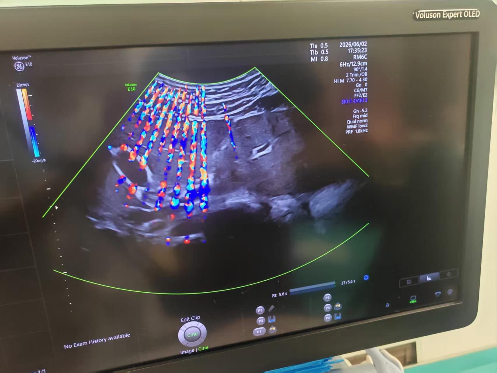 Repair service for GE Healthcare RM7C 3D/4D Convex Ultrasound Transducer