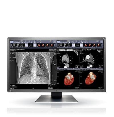 EIZO MX315W 8MP Medical Display Monitor