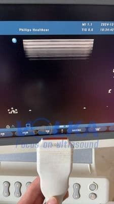 Philips L12-3 Linear Array Ultrasound Transducer