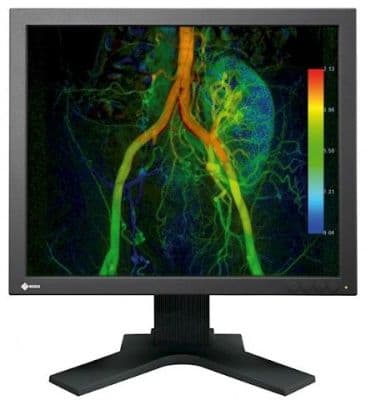 High-Brightness EIZO EX190-S Diagnostic Display Monitor