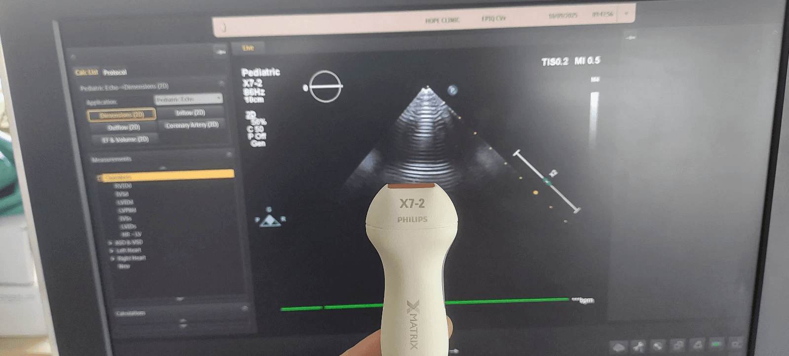 Philips X7-2 xMATRIX Sector Array Ultrasound Probe for EPIQ and Affiniti Systems – Live 3D Cardiac Transducer