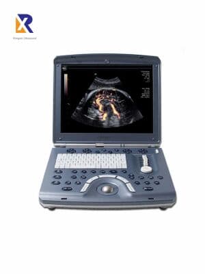 GE Voluson e Portable Ultrasound System