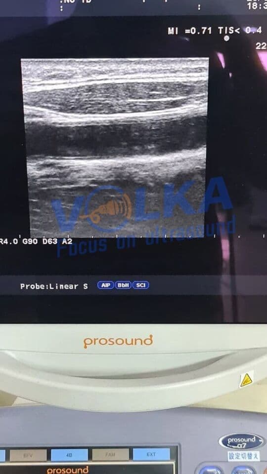Aloka UST-5412 Ultrasound Transducer