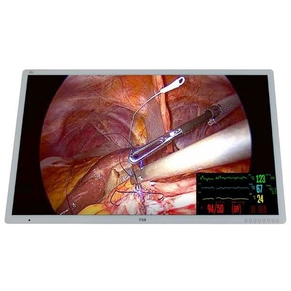 Surgical Display for Precise Instrument Positioning — Foreseeson FM-C5501DV 4K Monitor