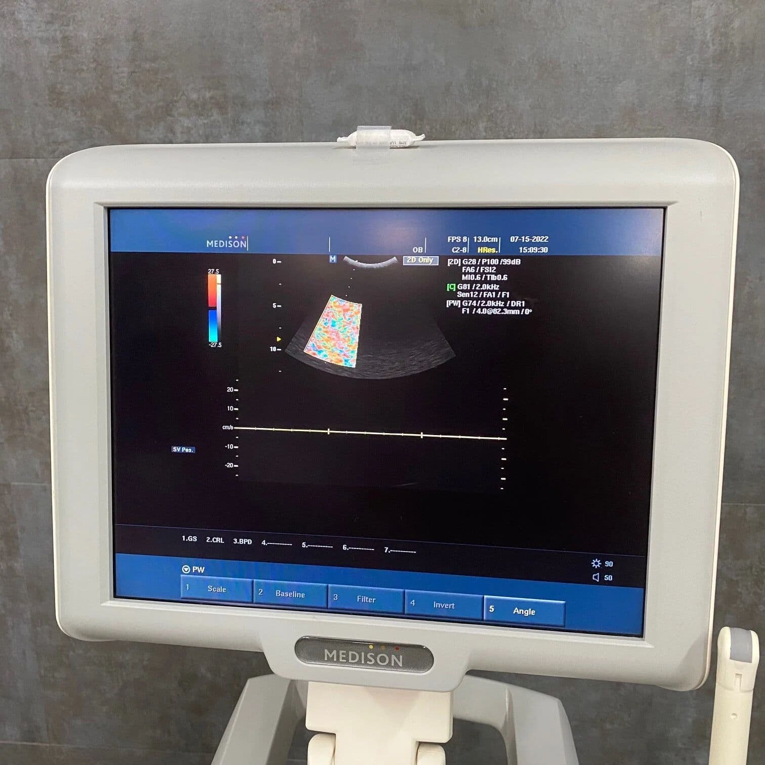 Samsung Medison SonoAce X6 Ultrasound System