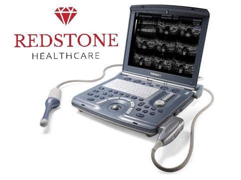 GE Voluson i Portable 4D OB/GYN Ultrasound System
