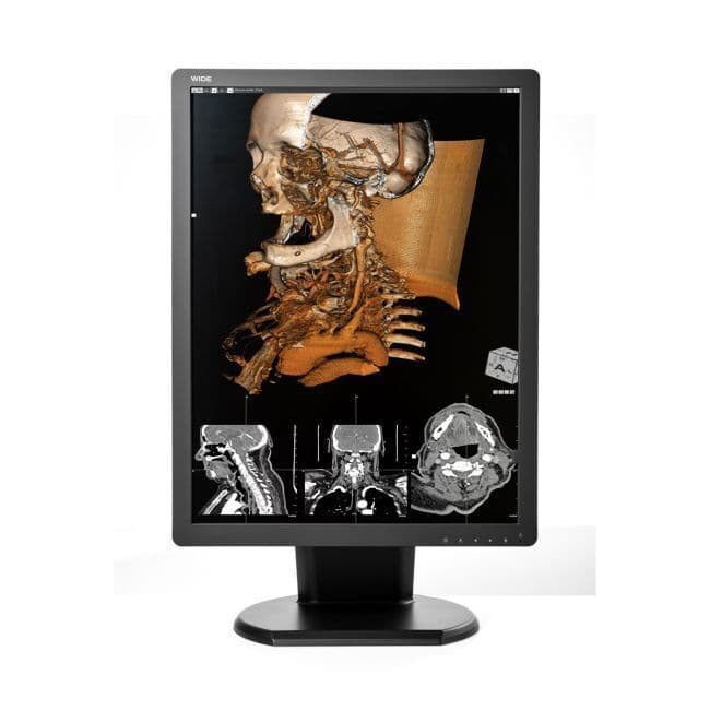 Diagnostic Display Monitor — WIDE CX30N 3MP