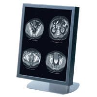 EIZO SMD21306D Grayscale Diagnostic Display Monitor