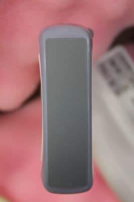 GE 4C-RS Convex Array Ultrasound Transducer