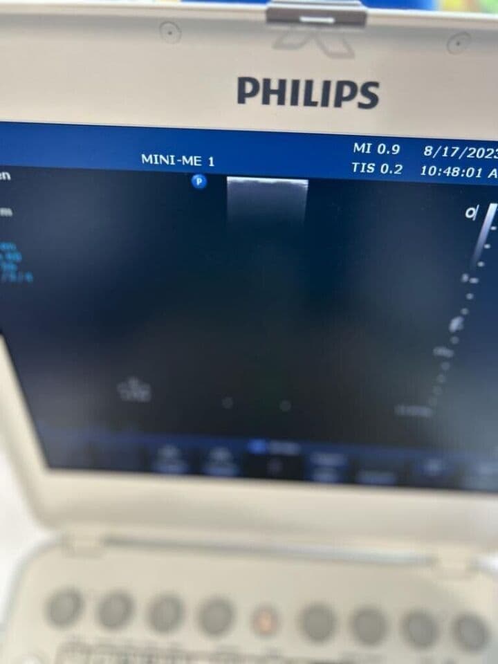 GE L12-3 Linear Array Ultrasound Transducer Probe
