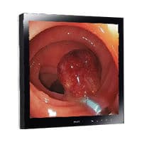 Surgical Display Monitor — FIMI E190S