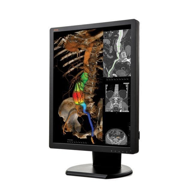 WIDE CX20N 2MP Diagnostic Display Monitor