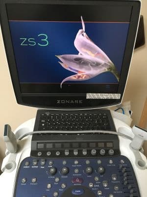Zonare ZS3 Shared Service Ultrasound System