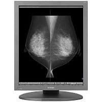Diagnostic Review Display — Totoku ME551i2 Medical Monitor