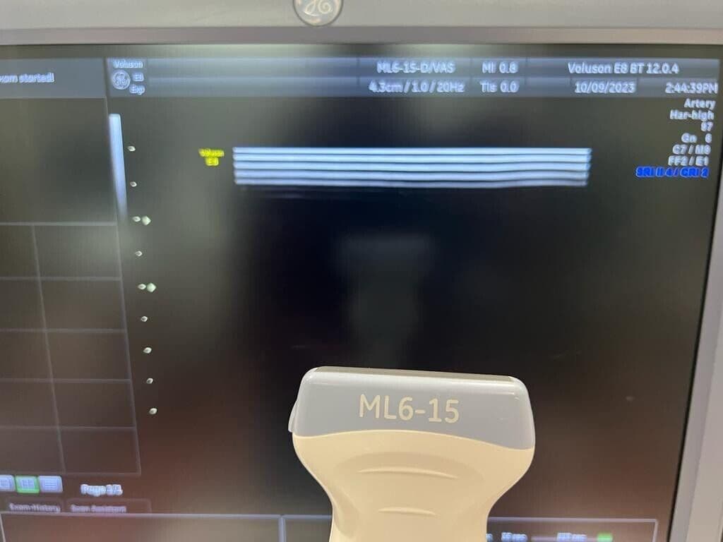 GE ML6-15-D Linear Array Ultrasound Transducer Probe