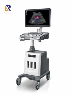 Mindray DC-30 OB/GYN Ultrasound System