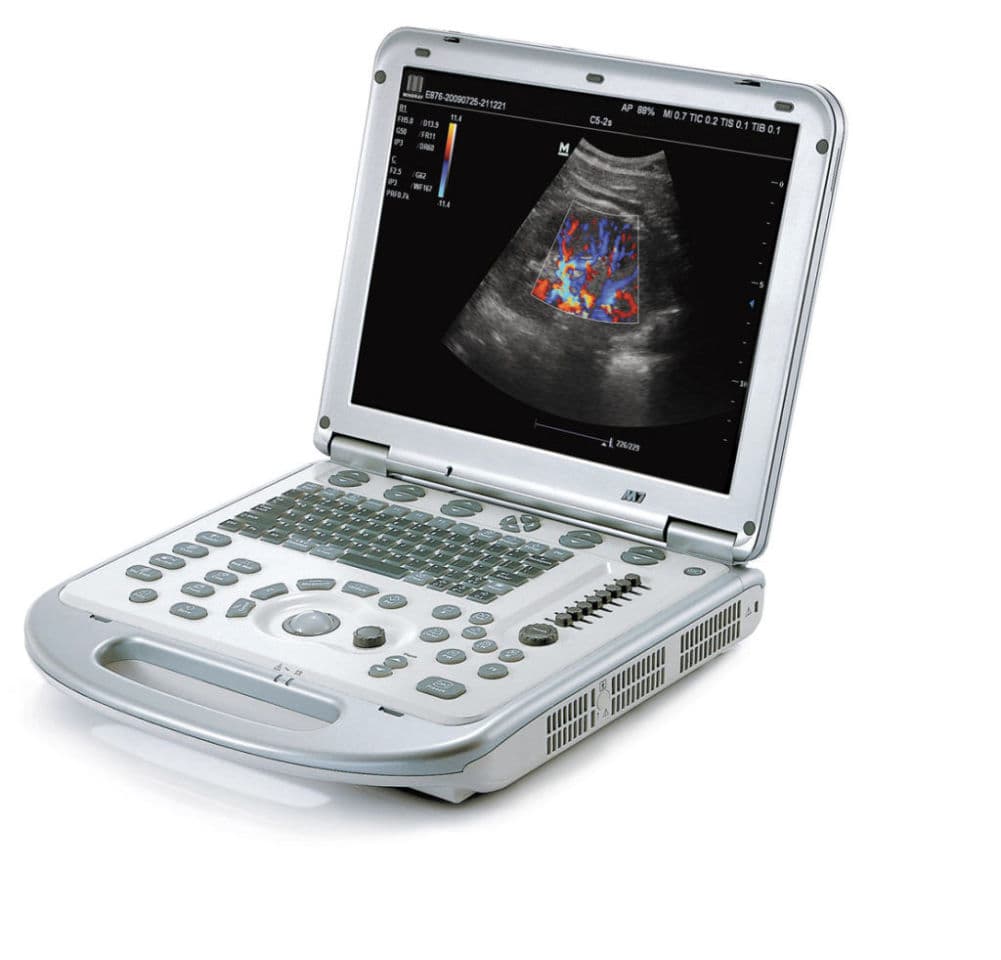 Mindray M7 Portable Ultrasound System for Pain Management and PRP